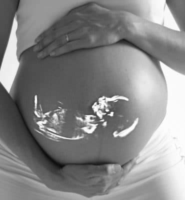 Maternity Ultrasound