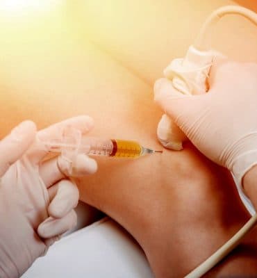 Steroid Injections