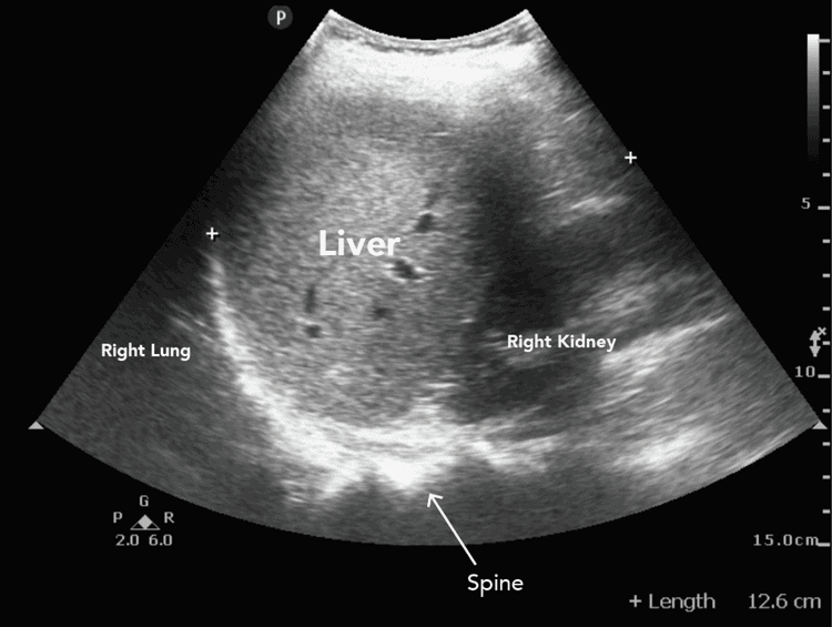 Ultrasound machine in use