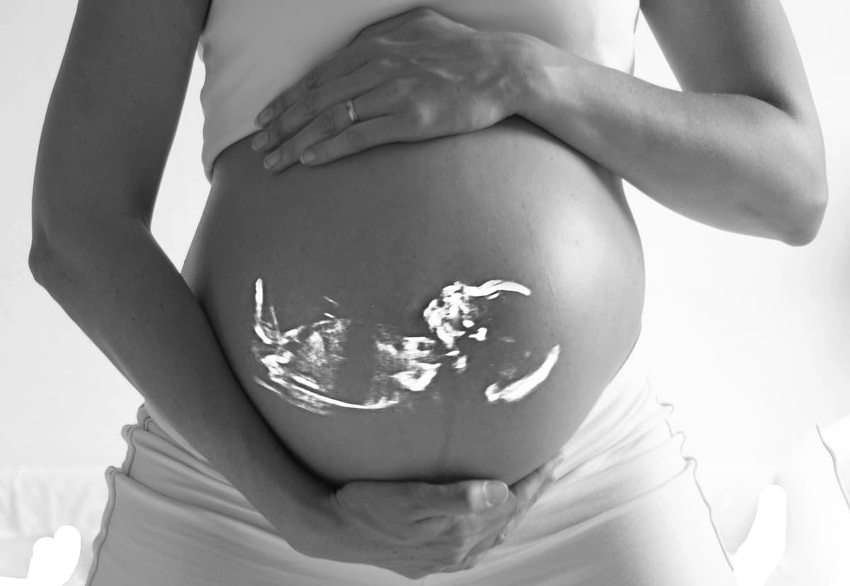 Pregnancy ultrasound