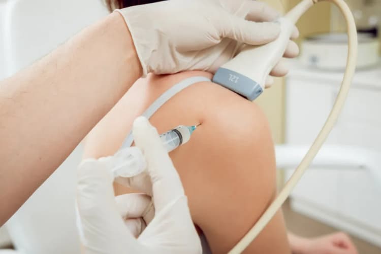 Steroid injection procedure