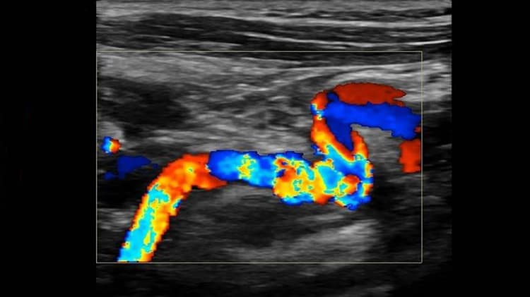 Ultrasound machine in use